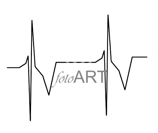 Herzrhythmus
