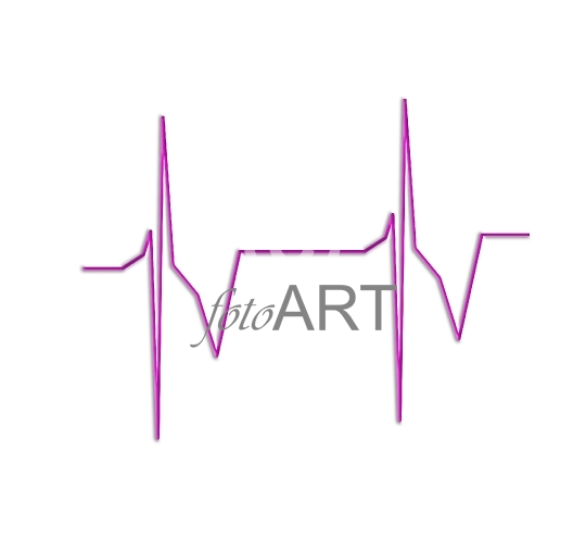 Herzrhythmus