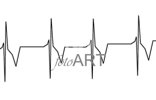 Herzrhythmus